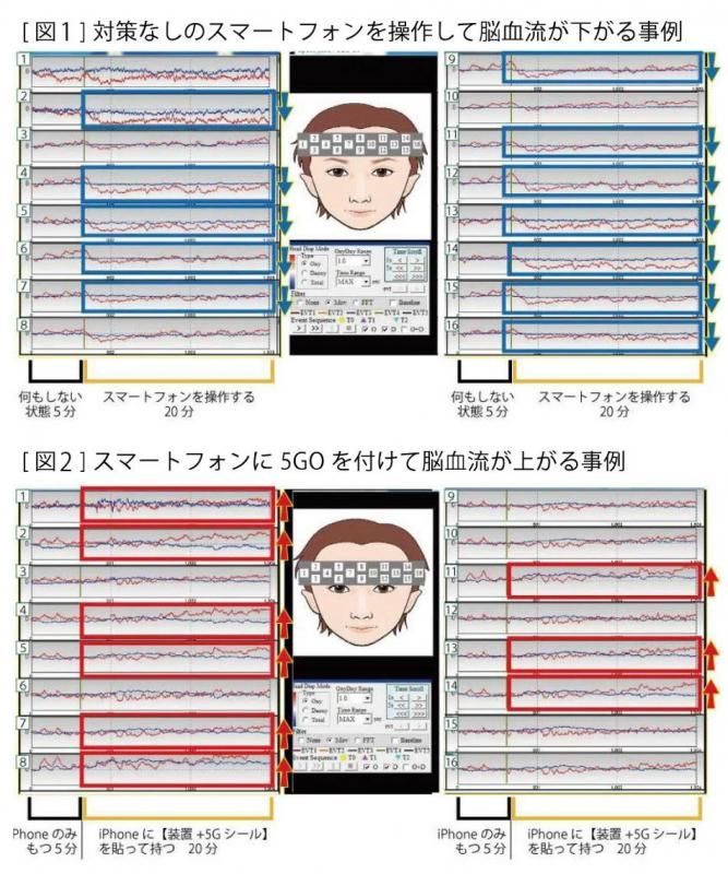 【お取り寄せ★納期 最長 約2週間】5GO Lightning★スマホ・タブレット等の強力電磁波ノイズ対策します