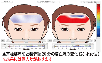 【お取り寄せ★納期 最長 約2週間】電磁波対策シリーズ スッキリ除電耳栓 ミミケア 耳鼻兼用★静電気除去！生体電流を高めて頭も視界も聴力もはっきり