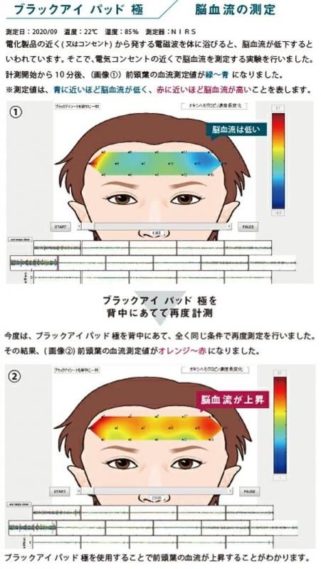 【お取り寄せ★納期 最長 約2週間】BLACK EYE PAD ブラックアイパッド 極★丸山式 ブラックアイシリーズ 電磁波防止 電磁波グッズ 電磁波対策 丸山先生監修 コイル 電磁波 電波