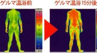 【市場最安】ゲルマニウム温浴 トリプル シェイプストーン