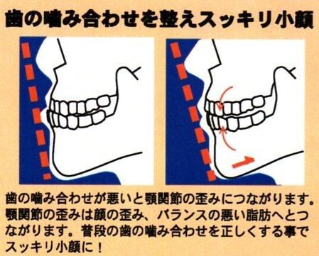 【市場最安】ゲルマニウム 小顔 マウスピース
