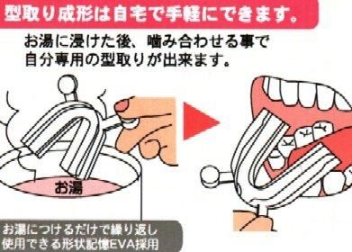【市場最安】ゲルマニウム 小顔 マウスピース